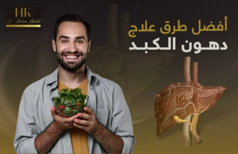 علاج دهون الكبد بأفضل الطرق فى رأي د/حاتم خليل