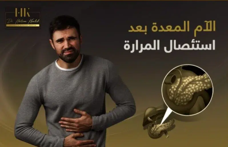 الام المعدة بعد استئصال المرارة بالمنظار