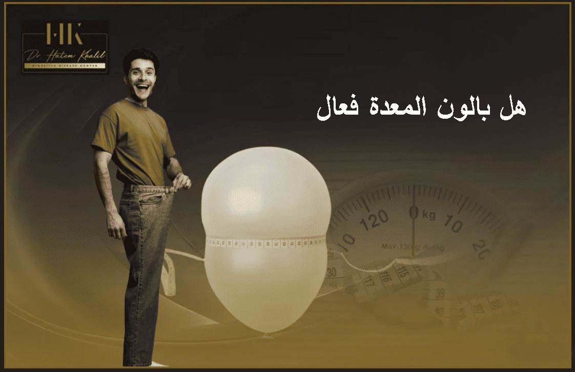هل بالون المعدة فعال