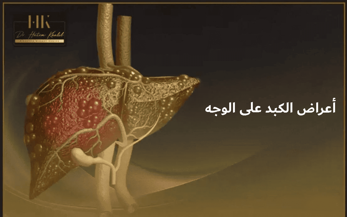 أعراض الكبد على الوجه