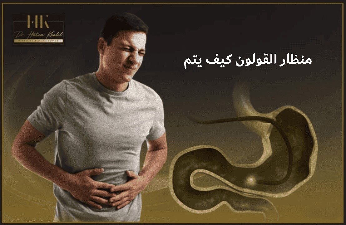 منظار القولون كيف يتم