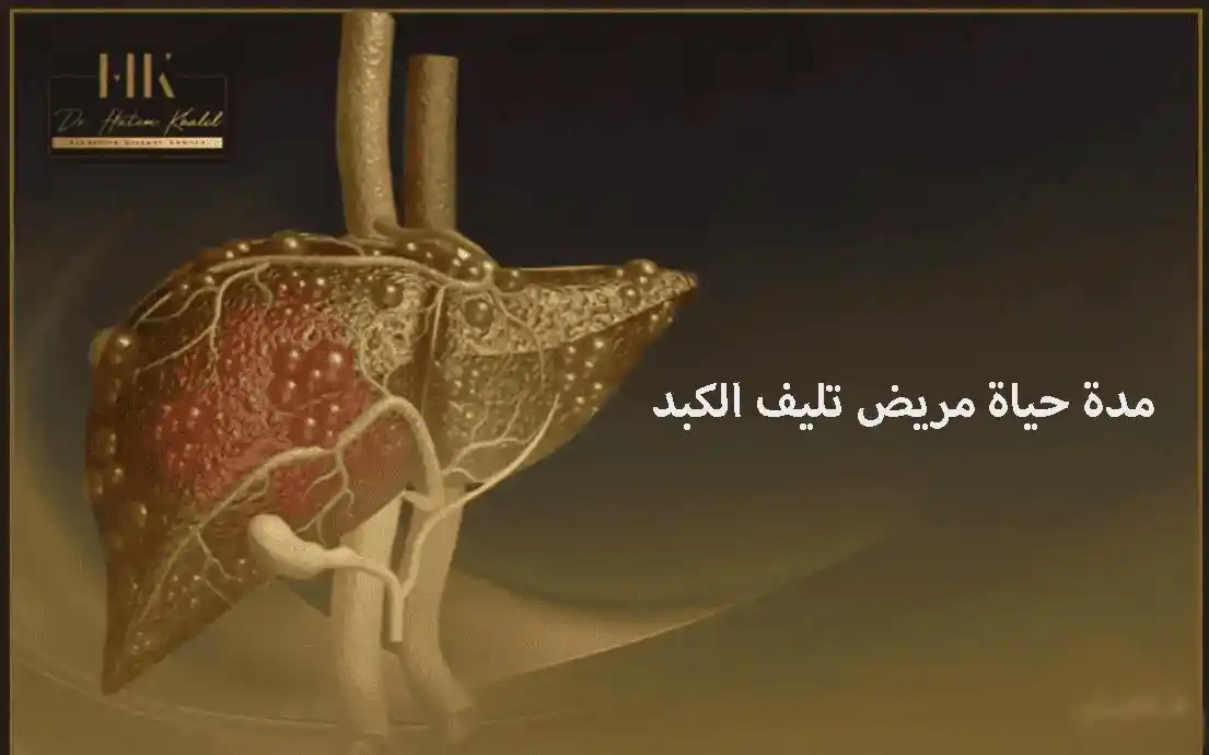 مدة حياة مريض تليف الكبد : كم يعيش في كل مرحلة؟