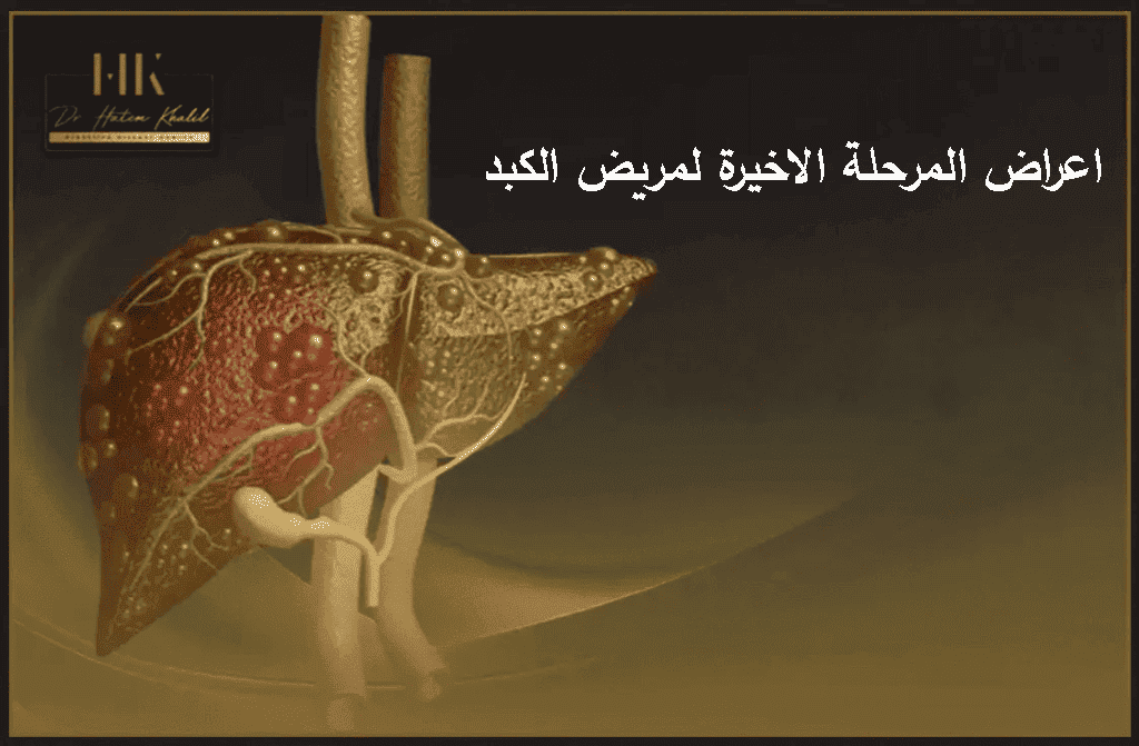 اعراض المرحلة الاخيرة لمريض الكبد