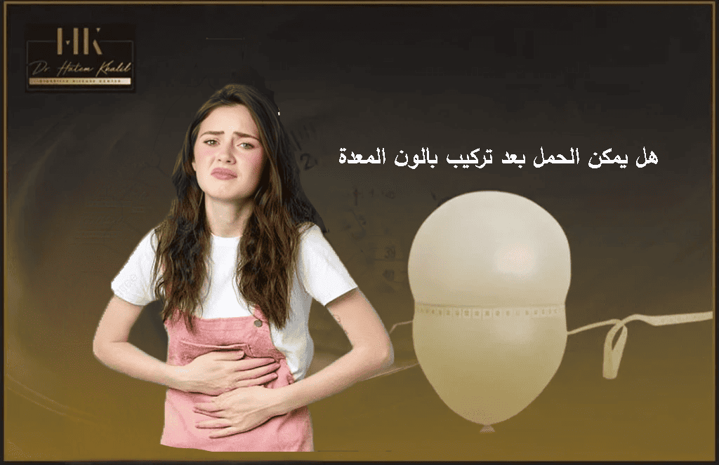 هل يمكن الحمل بعد تركيب بالون المعدة